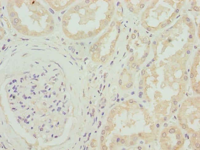 100UL CACNB1 ANTIBODY 100 ul