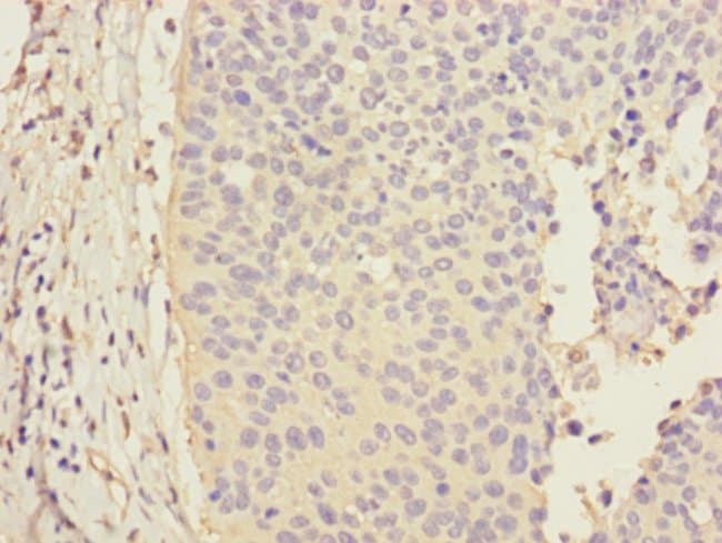 100UL CALML3 ANTIBODY 100 ul