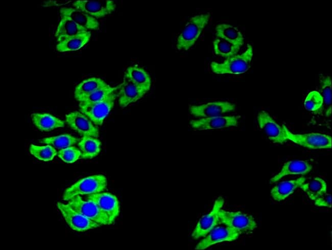 100UG CAMLG ANTIBODY 100 ug
