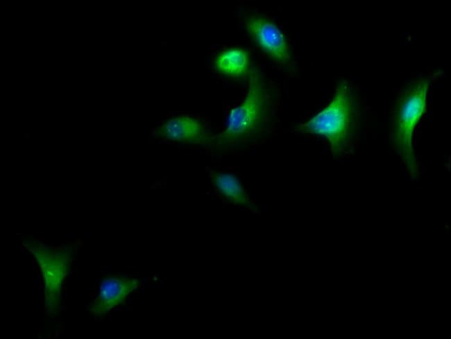 100UL CAP1 ANTIBODY 100 ul