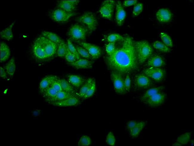 100UG CALPAIN 2 ANTIBODY 100 ug