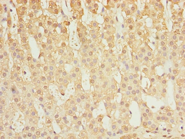 100UL CALPAIN S1 ANTIBODY 100 ul