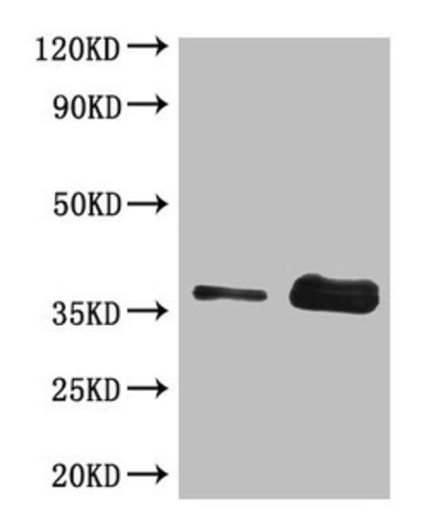 100UG GLIADIN ANTIBODY 100 ug