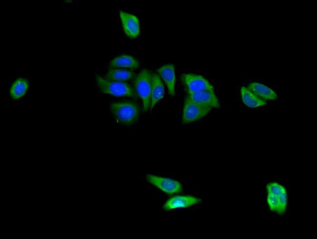 100UG CAPZA1 ANTIBODY 100 ug