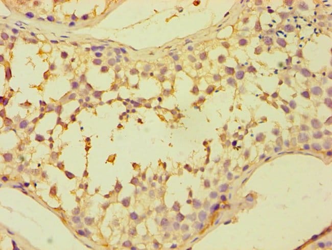 100UL CAPZB ANTIBODY 100 ul