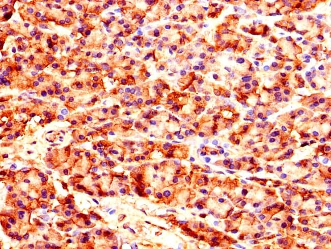 100UG CARS ANTIBODY 100 ug