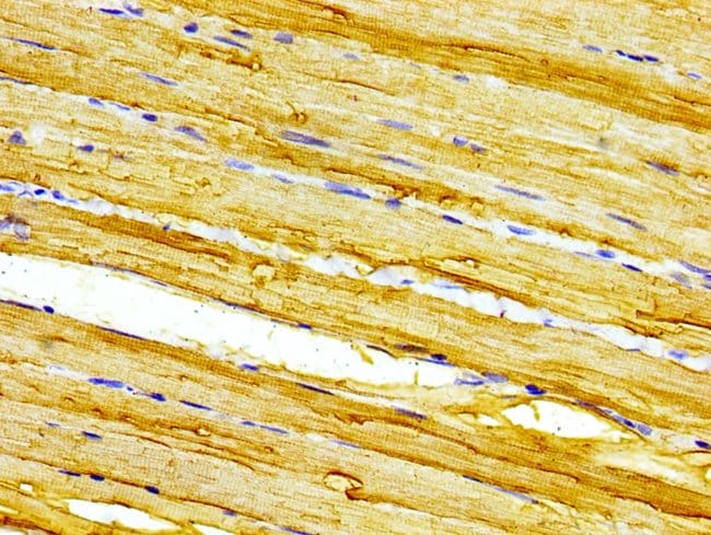 100UG CALSEQUESTRIN 2 ANTIBODY 100 ug