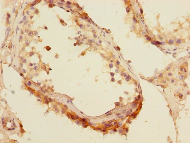 100UL MTGR1 ANTIBODY 100 ul