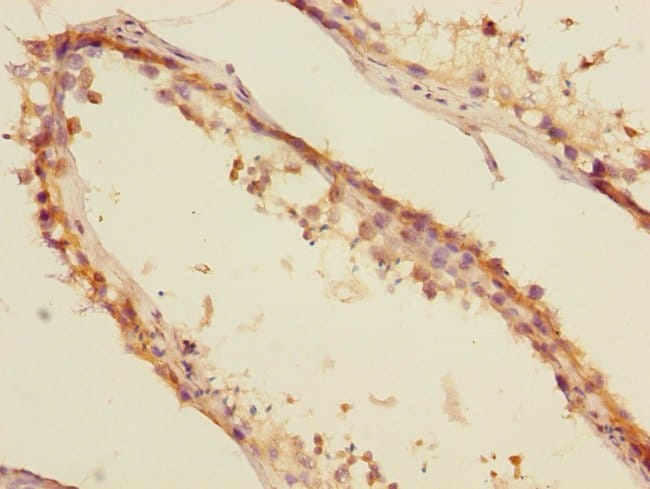 100UL MTGR1 ANTIBODY 100 ul