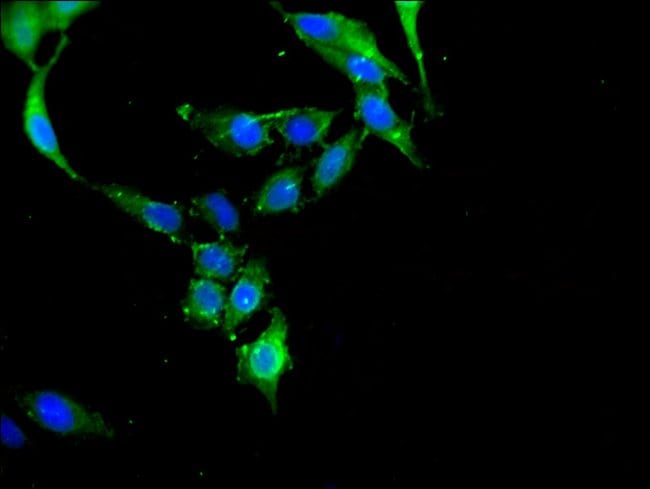 100UG C-CBL ANTIBODY 100 ug