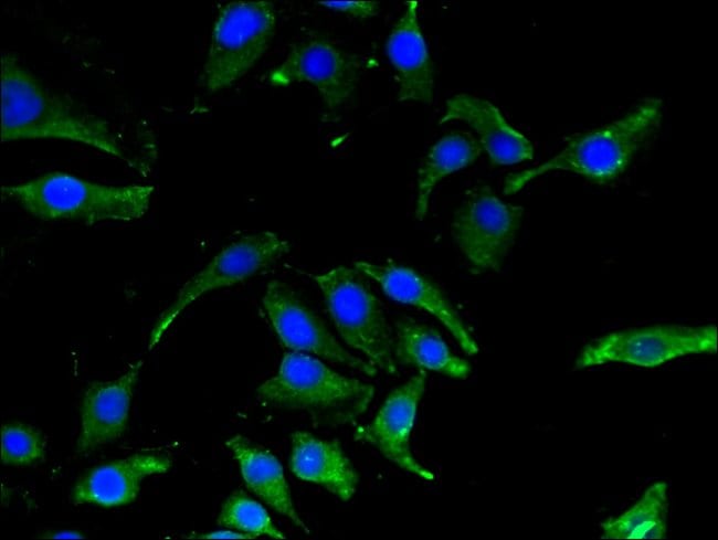 100UG CBR1 ANTIBODY 100 ug