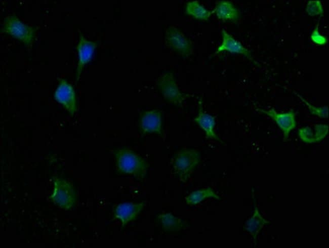 100UG YARS ANTIBODY 100 ug