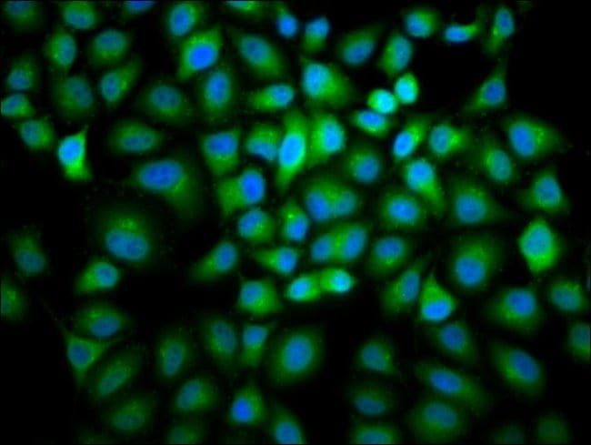100UG CYCLIN B2 ANTIBODY 100 ug