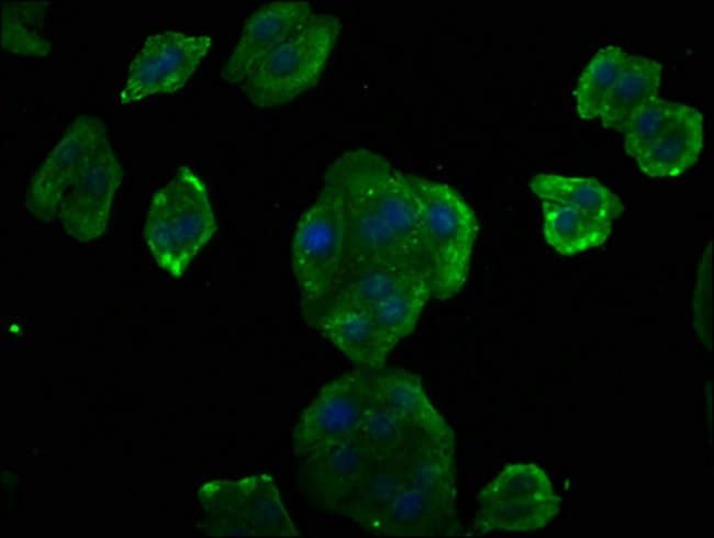 100UL CYCLIN D2 ANTIBODY 100 ul