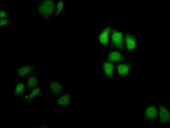 100UL CYCLIN D3 ANTIBODY 100 ul