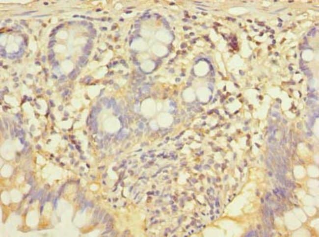 100UG CCNJL ANTIBODY 100 ug