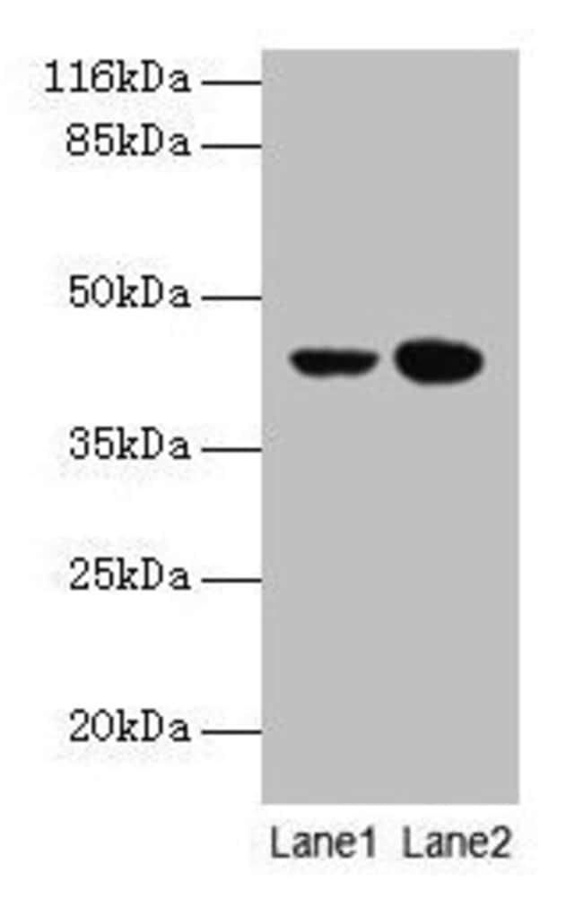 100UG CCR6 ANTIBODY 100 ug