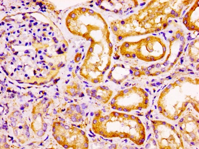100UG CCRL2 ANTIBODY 100 ug