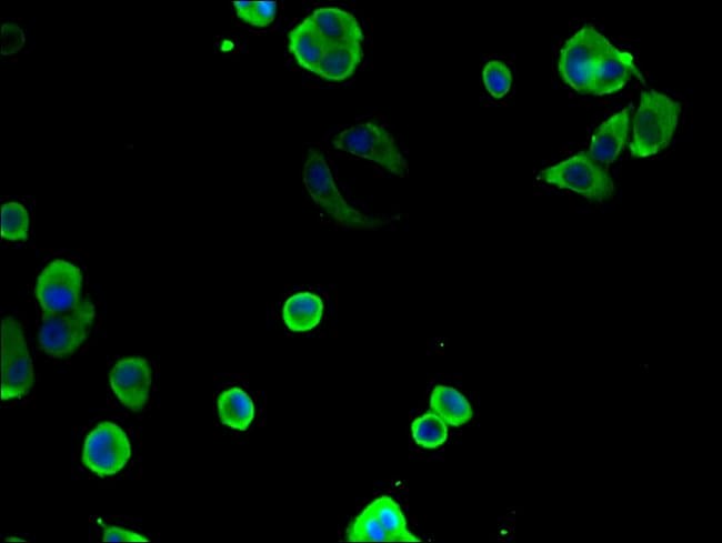 100UG TCP-1 THETA ANTIBODY 100 ug