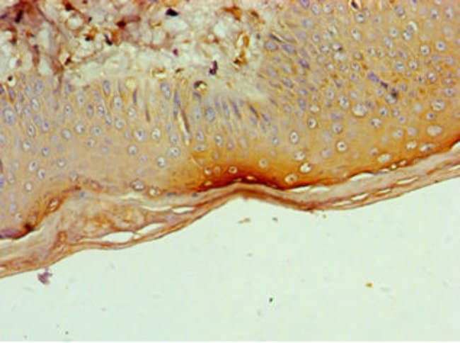100UL CD1A ANTIBODY 100 ul