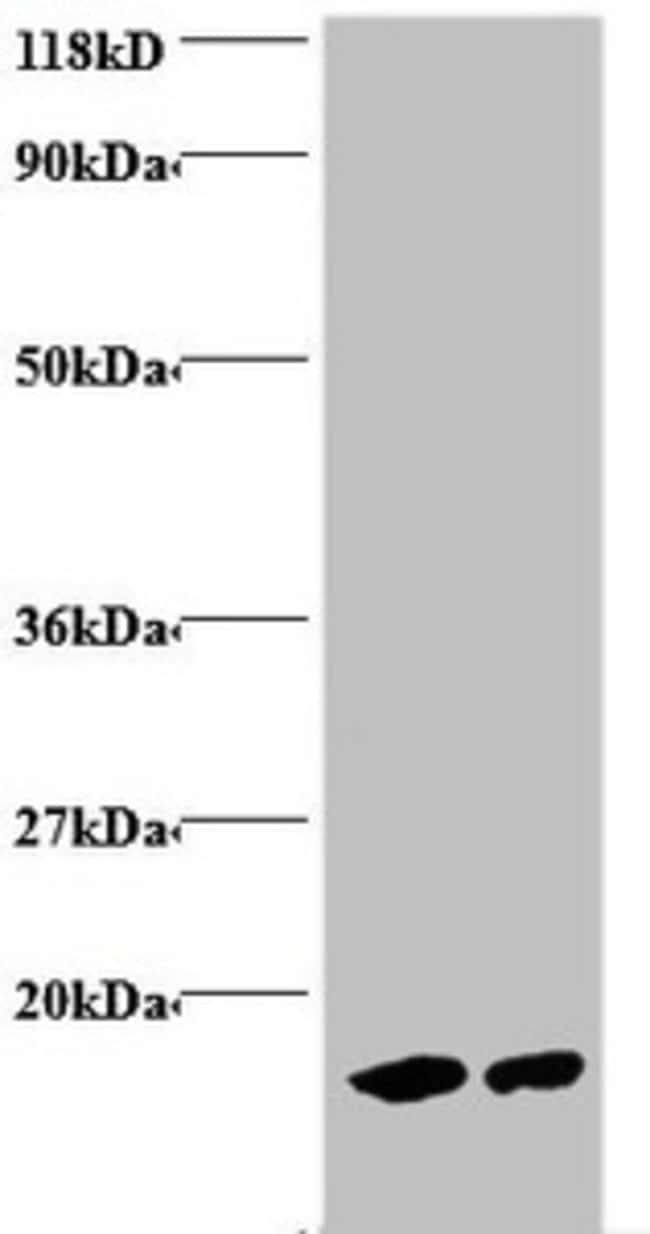 100UG HEMOGLOBIN ANTIBODY 100 ug