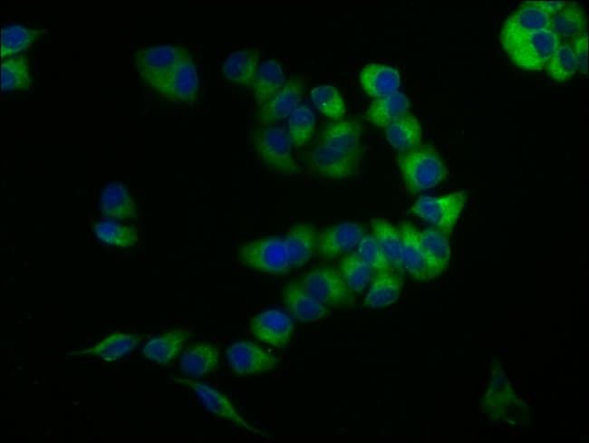 100UG CD59 ANTIBODY 100 ug