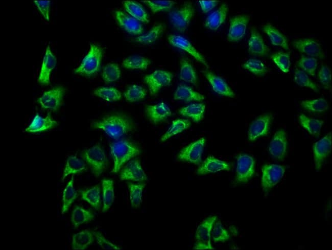 100UG CD72 ANTIBODY 100 ug