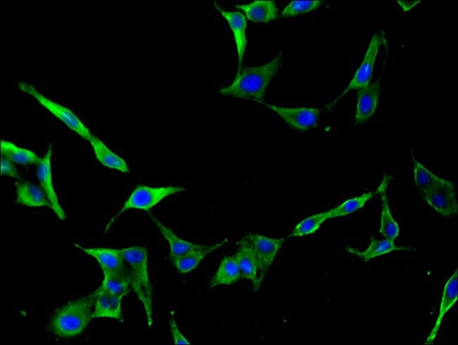 100UG CDC25B ANTIBODY 100 ug