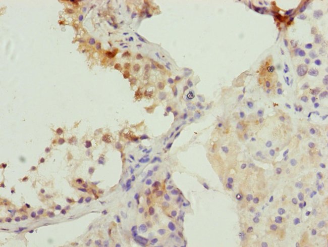 100UL CDC45L ANTIBODY 100 ul
