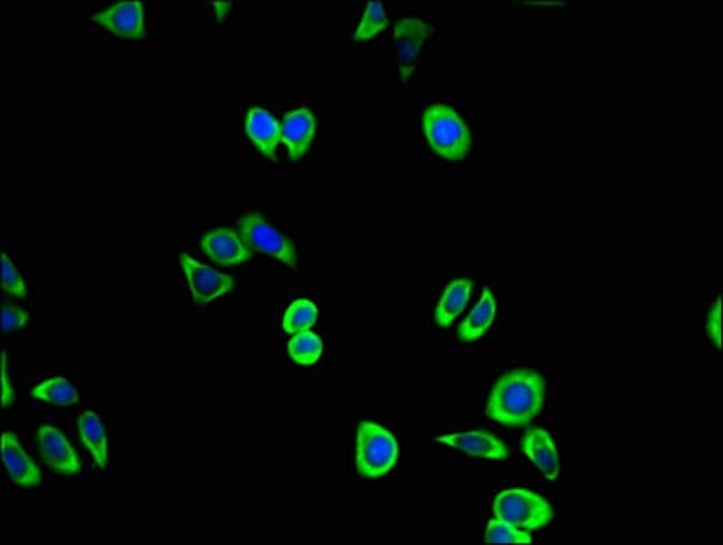 100UG CDK5 ANTIBODY 100 ug