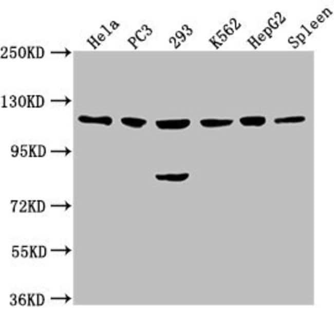 100UL CDKL5 ANTIBODY 100 ul