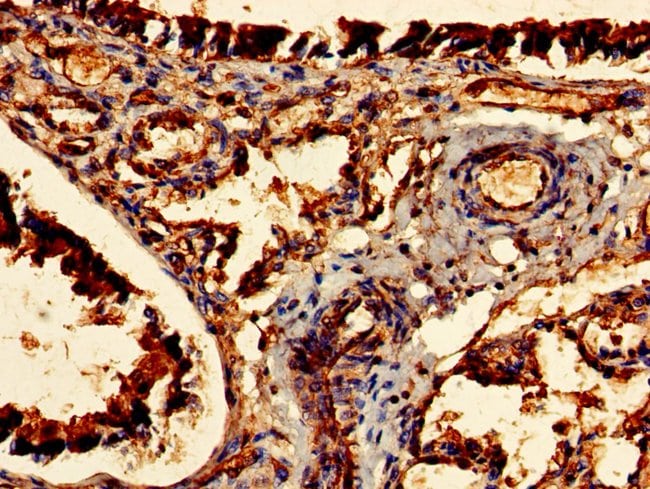 100UG CDR2 ANTIBODY 100 ug