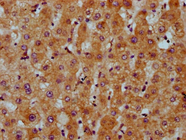 100UG CDS2 ANTIBODY 100 ug