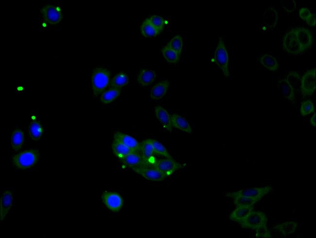 100UG CDSN ANTIBODY 100 ug
