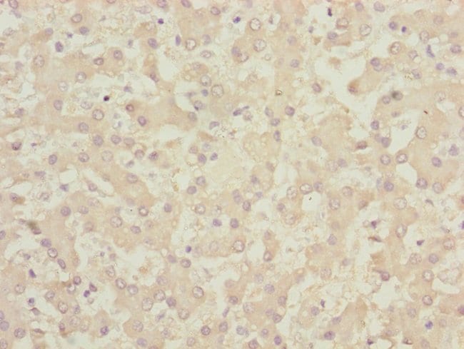 100UL CENPK ANTIBODY 100 ul