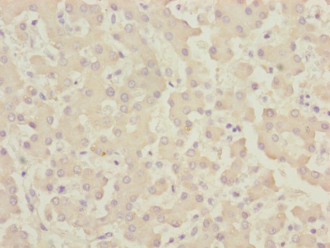 100UL CENPK ANTIBODY 100 ul