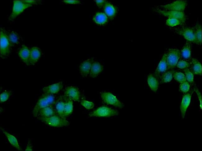 100UG CES1 ANTIBODY 100 ug