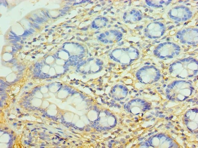 100UL COMPLEMENT FACTOR H ANTIBODY 100 u