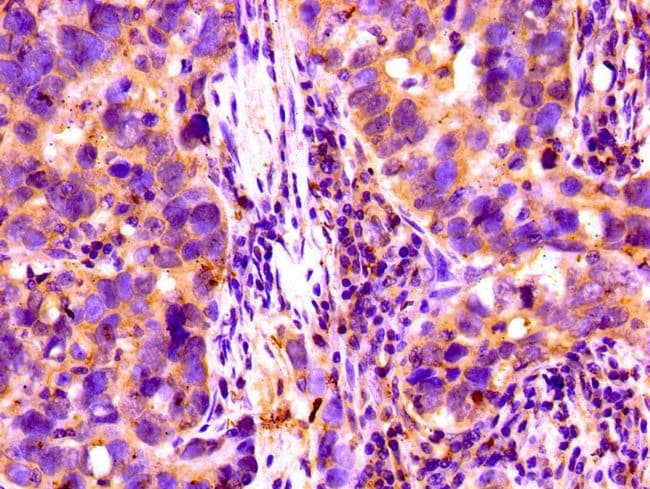 100UG COMPLEMENT FACTOR I ANTIBODY 100 u
