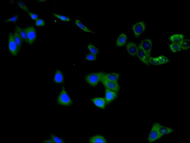 100UG CHAT ANTIBODY 100 ug