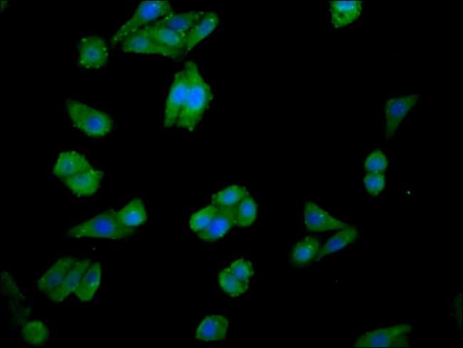 100UG CHKA ANTIBODY 100 ug