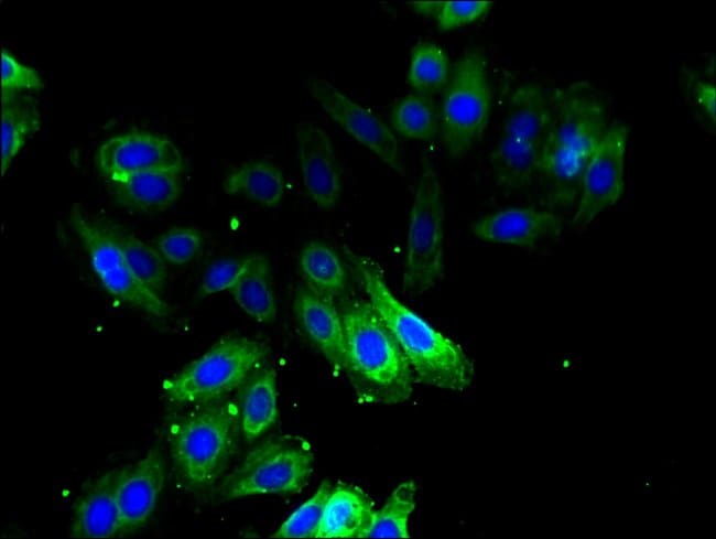 100UG ODC1 ANTIBODY 100 ug