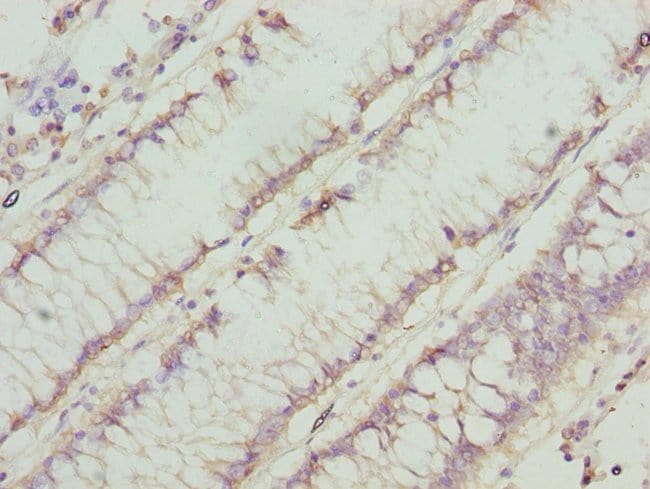 100UL CHN1 ANTIBODY 100 ul