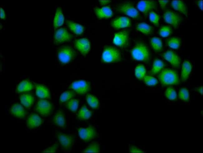 100UG CHONDROLECTIN ANTIBODY 100 ug