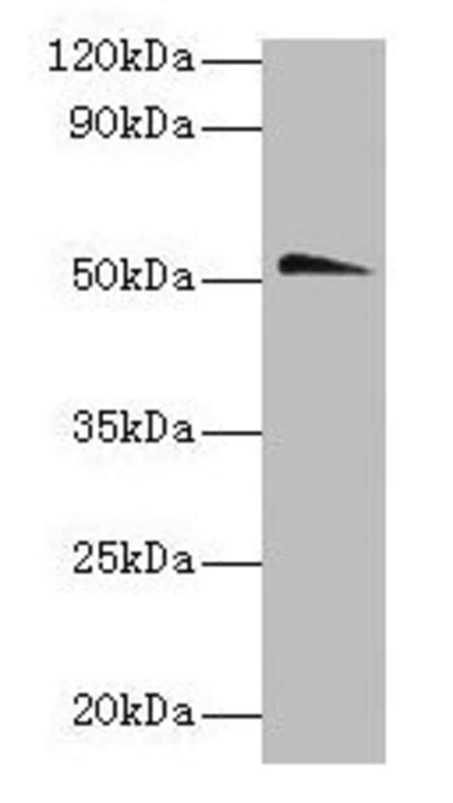 100UG CHRNA1 ANTIBODY 100 ug