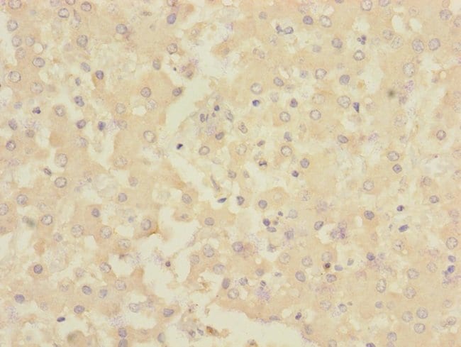 100UL CHRNE ANTIBODY 100 ul