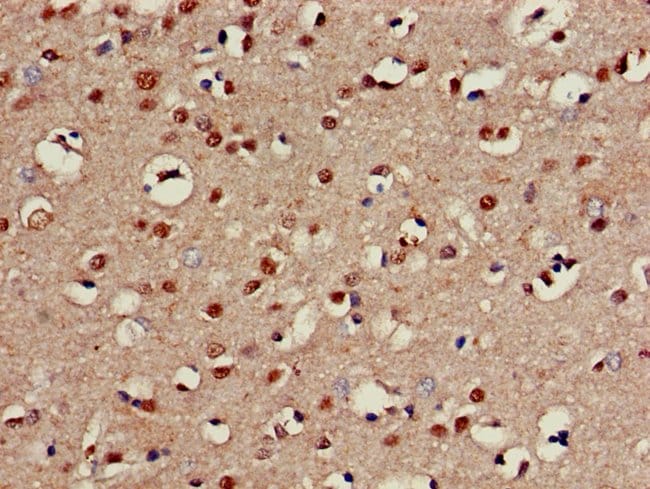 100UG CHST1 ANTIBODY 100 ug