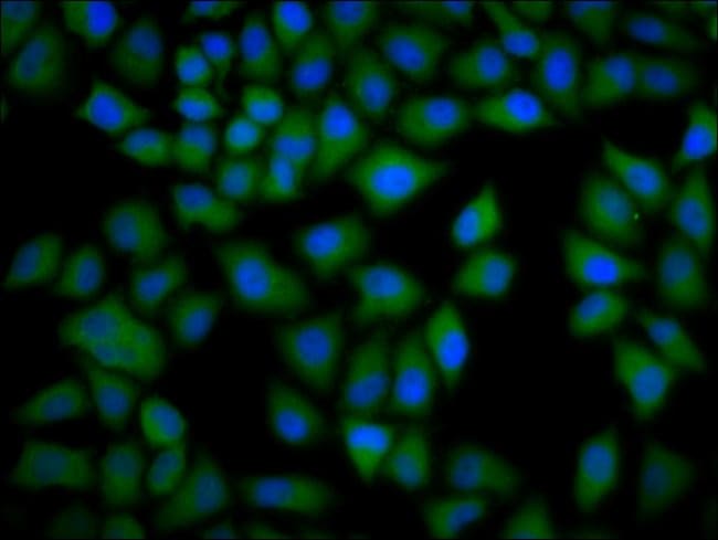 100UG CKAP4 ANTIBODY 100 ug