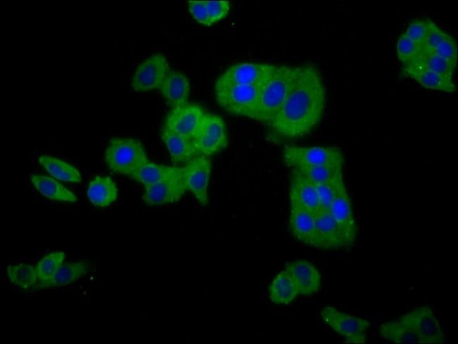 100UG CLCNKB ANTIBODY 100 ug