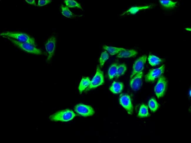 100UG CLAUDIN 20 ANTIBODY 100 ug